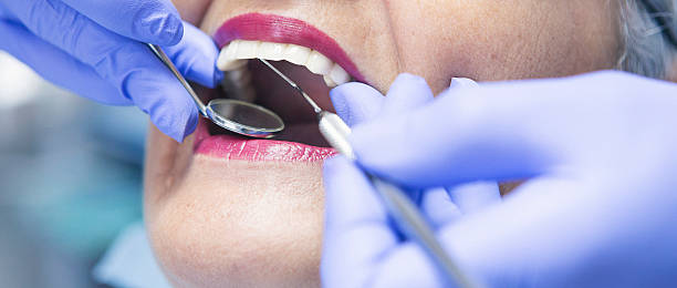 Best Chipped Tooth Repair Near Me  in Westminster, CA